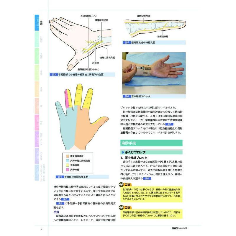 手の外科 私のアプローチ 第2版