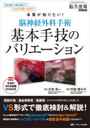 脳神経外科手術基本手技のバリエーション 手術のWEB動画55本付き 何が違って何が同じ?なぜその違いが出る?本質が知りたい! [本]