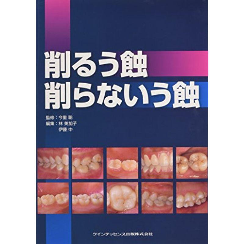 削るう蝕 削らないう蝕