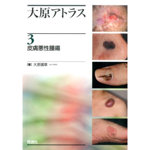 大原アトラス 皮膚悪性腫瘍