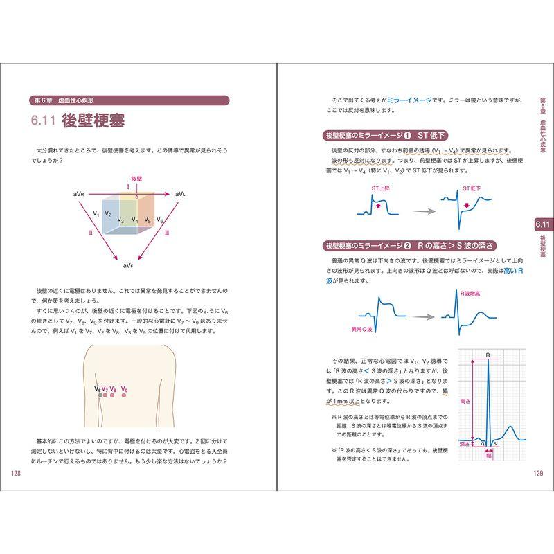 レジデントのための これだけ心電図