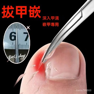 🔥好物優選🔥不銹鋼拔甲溝炎專用鉗子 指甲鉗 灰指甲 修腳鉗 鷹嘴鉗 拔嵌甲鉗鑷夾子 修腳工具 直彎頭超細特尖 MVMP