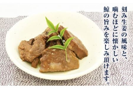 鯨缶詰 鯨缶 鯨大和煮 鯨須の子大和煮 ひげ鯨 缶詰 食べ比べ 2種10缶セット 鯨の缶詰 木の屋石巻水産