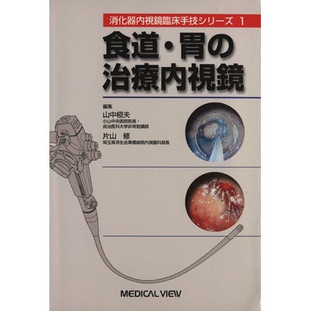 食道・胃の治療内視鏡 消化器内視鏡臨床手技シリーズ１／片山修(編者),山中桓夫(編者)