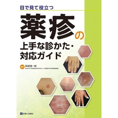 目で見て役立つ　薬疹の上手な診かた・対応ガイド   阿部理一郎  〔本〕