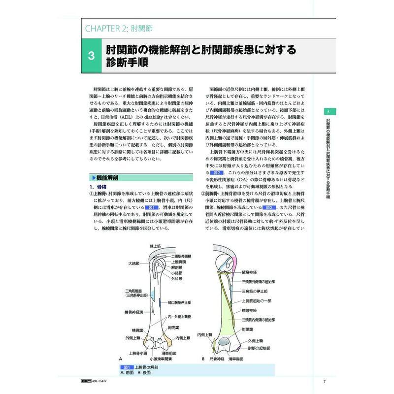 手の外科 私のアプローチ 第2版