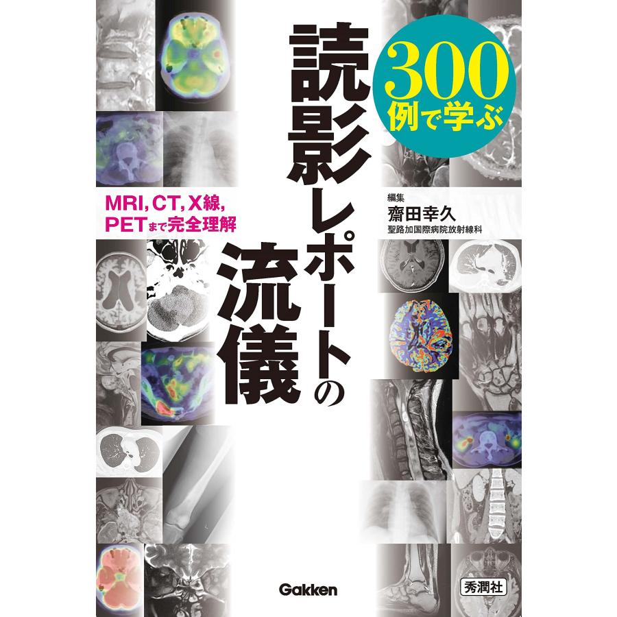 300例で学ぶ読影レポートの流儀 MRI,CT,X線,PETまで完全理解 齋田幸久