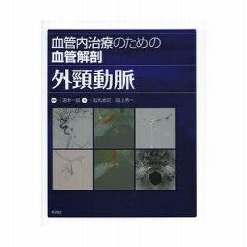 血管内治療のための血管解剖 外頸動脈 Amazon.co.jp: 血管内治療のための血管解剖 外頸動脈 : 清末一路