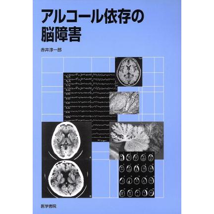 アルコール依存の脳障害／赤井淳一郎(著者)