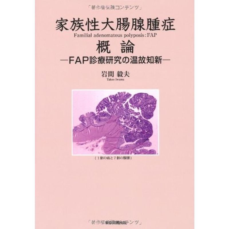 家族性大腸腺腫症概論?FAP診療研究の温故知新