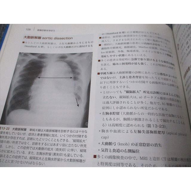 VI93-095 ELSEVIER 画像診断を学ぼう 単純X線からCT・MRI・超音波まで 第2版 2008 17M3C