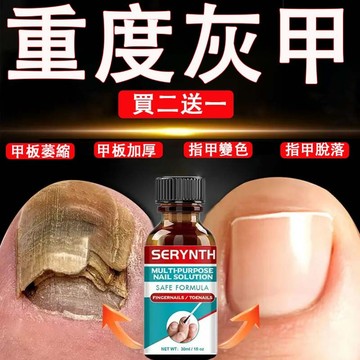 台灣出貨🥇【買二送一】🥇灰指指甲液 自帶磨甲片 軟化厚甲/改善黃黑變形 無刺激無需拔甲 灰/指/甲/液/指/甲