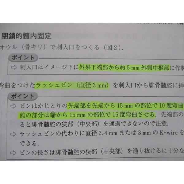 TT93-016 金芳堂 整形外科手術プラクティス 玉造厚生年金病院の方法 1999 三木尭明 小谷博信 千束福司 長谷隆生 29M1D