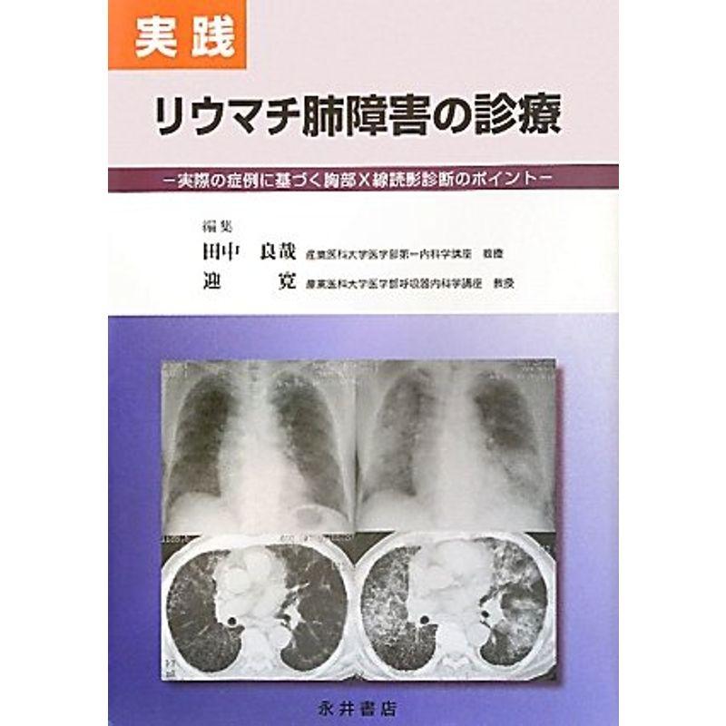 実践 リウマチ肺障害の診療?実際の症例に基づく胸部X線読影診断のポイント