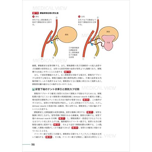 究める 腎・副腎腫瘍に対する腹腔鏡・ロボット支援手術