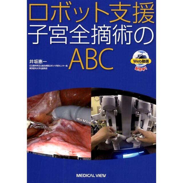 ロボット支援子宮全摘術のABC 井坂惠一