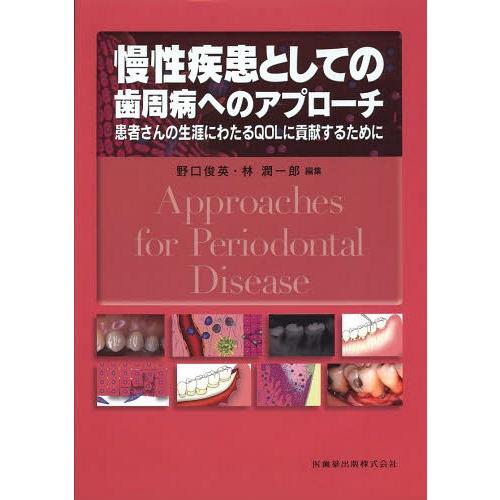 慢性疾患としての歯周病へのアプローチ 患者さんの生涯にわたるQOLに貢献するために