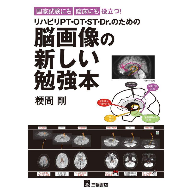 国家試験にも臨床にも役立つ リハビリPT・OT・ST・Dr.のための脳画像の新しい勉強本