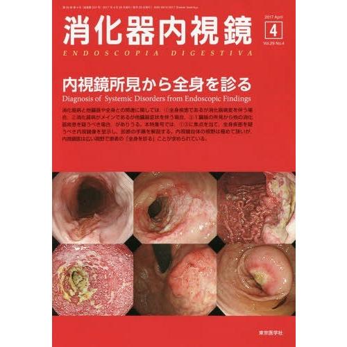 消化器内視鏡 Vol.29No.4 消化器内視鏡編集委員会 編