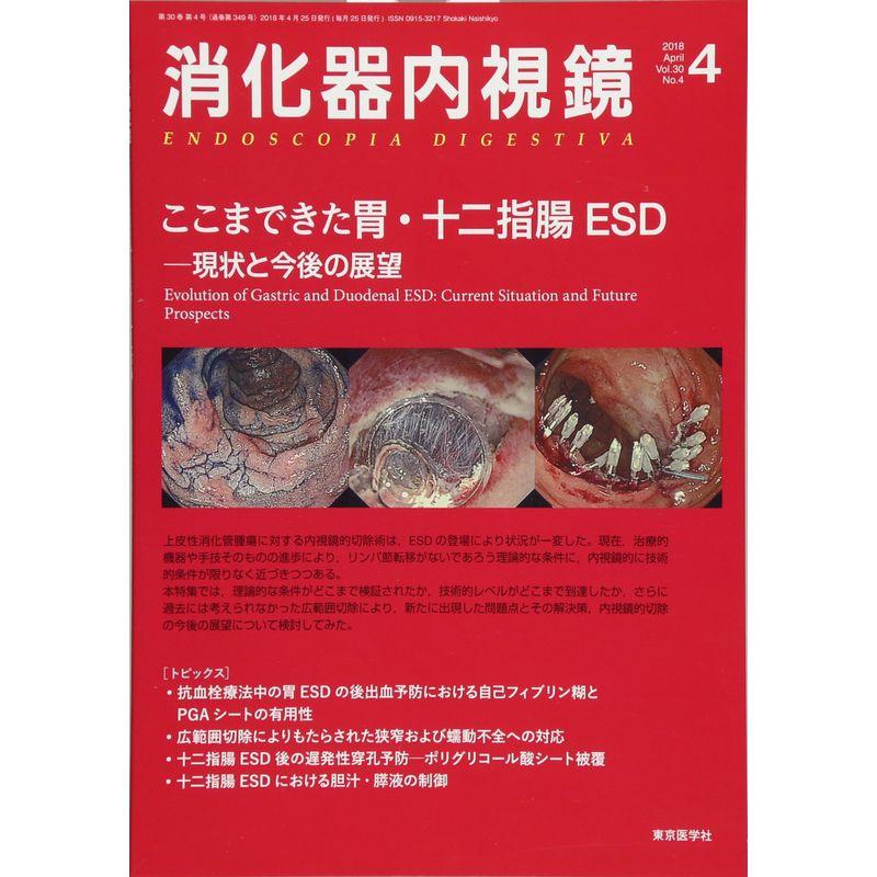 消化器内視鏡 Vol.30 No.4(201 ここまできた胃・十二指腸ESDー現状と今後の展望