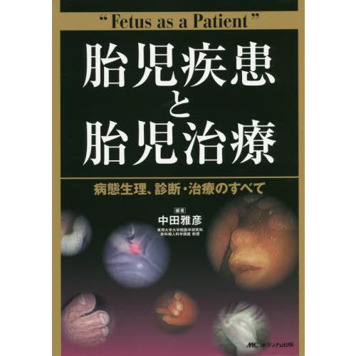 胎児疾患と胎児治療 病態生理,診断・治療のすべて