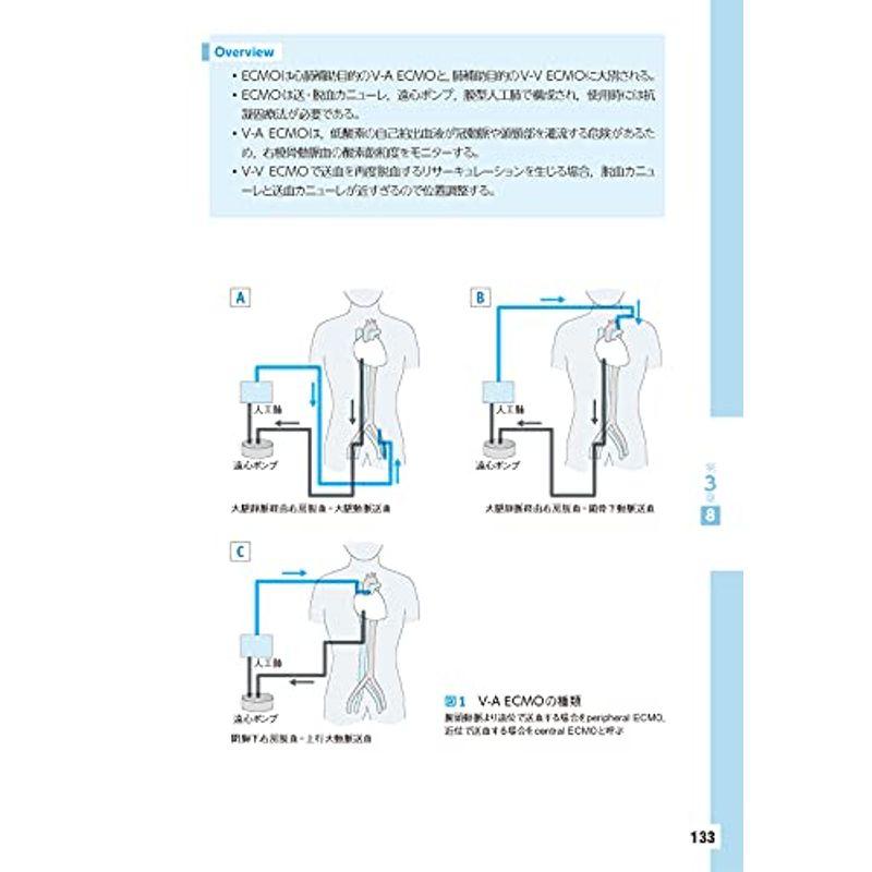 胸部手術の麻酔 一側肺換気の手技と知識を知る電子版付