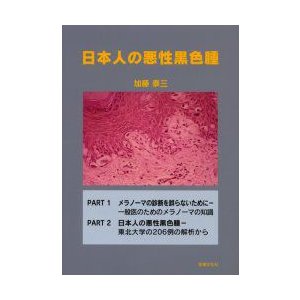 日本人の悪性黒色腫