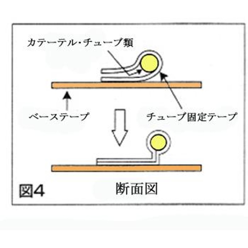 トップ a-line固定テープ