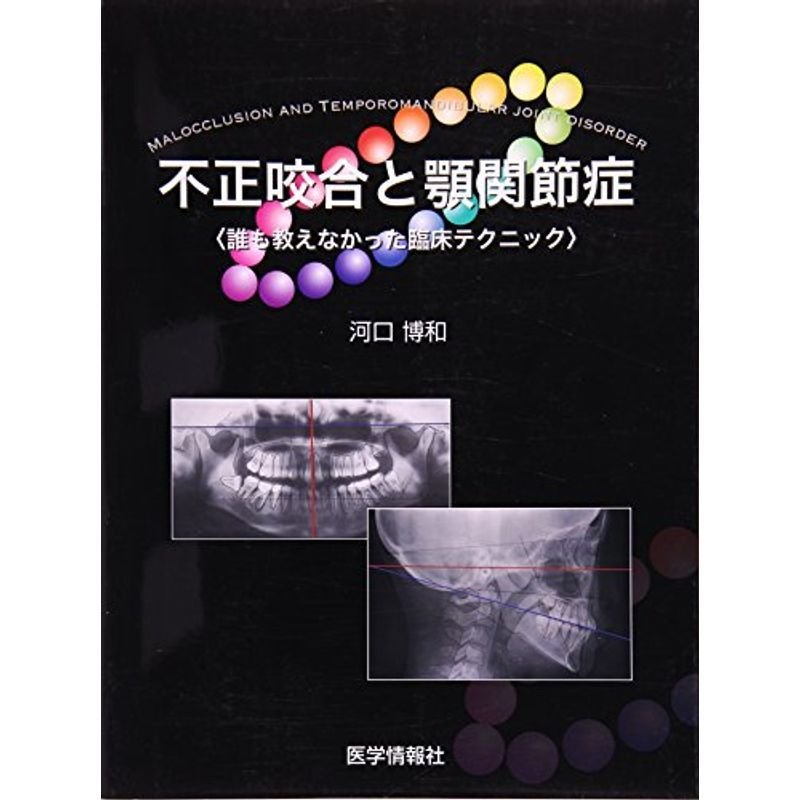 不正咬合と顎関節症 誰も教えなかった臨床テクニック