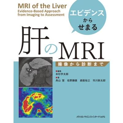 エビデンスからせまる肝のMRI 撮像から診断まで   本杉宇太郎  〔本〕