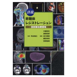 詳説非剛体レジストレーション-放射線治療領域