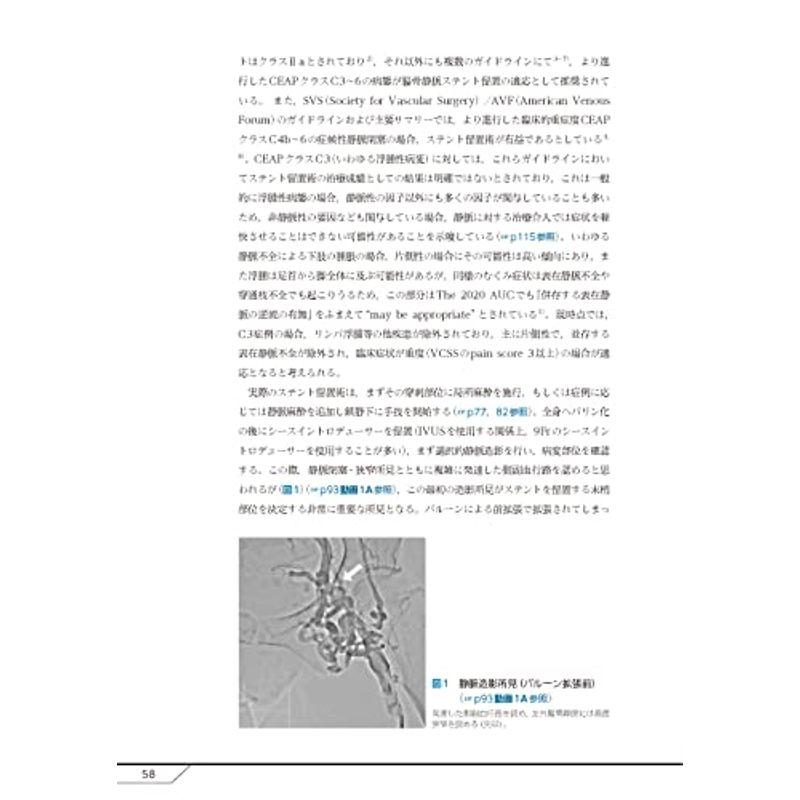 慢性深部静脈不全の評価と治療 -動画を含む電子版付-