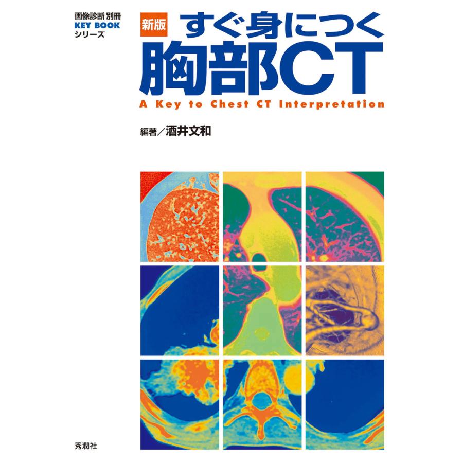 すぐ身につく胸部CT 酒井文和