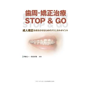 歯周-矯正治療　STOP  GO 成人矯正を成功させるためのクリニカルポイント