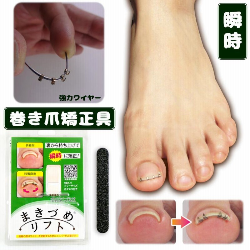 まき爪リフト　4個セット【正規品】 楽天市場】まきづめリフト 巻き爪リフト 巻き爪 まきづめ 矯正