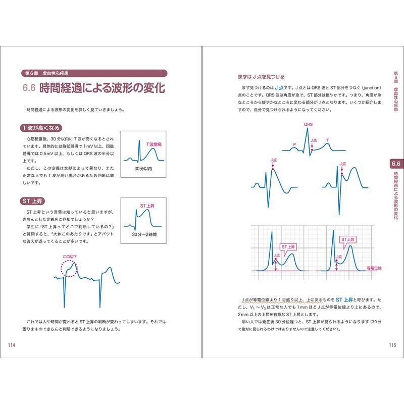 レジデントのための これだけ心電図