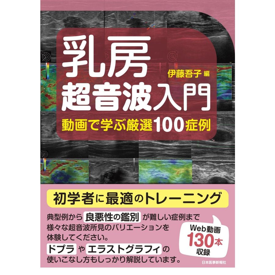 乳房超音波入門-動画で学ぶ厳選１００症例