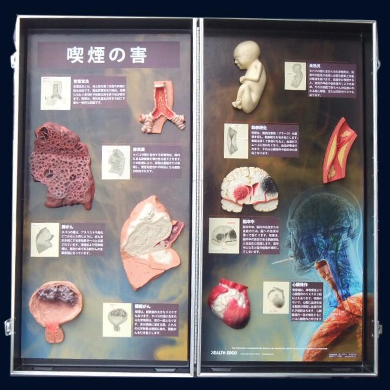 HEALTH EDCO 喫煙の影響 人体模型セット 展示用模型ディスプレイ 喫煙の害 リアルな教材で見る禁煙教育