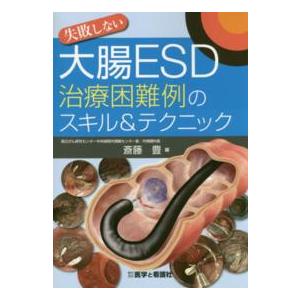 失敗しない大腸ESD治療困難例のスキル テクニック