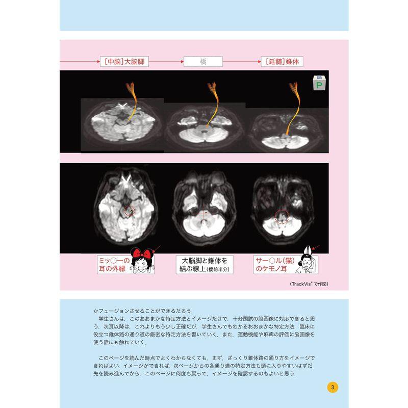 国家試験にも臨床にも役立つ リハビリPT・OT・ST・Dr.のための脳画像の