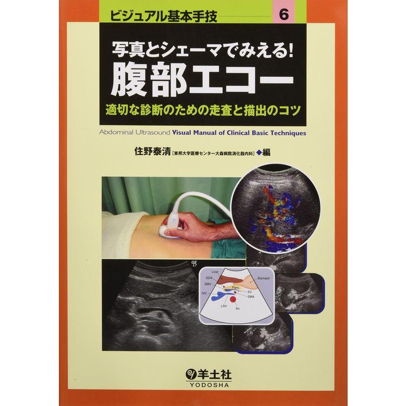 写真とシェーマでみえる腹部エコー?適切な診断のための走査と描出のコツ (ビジュアル基本手技 6)