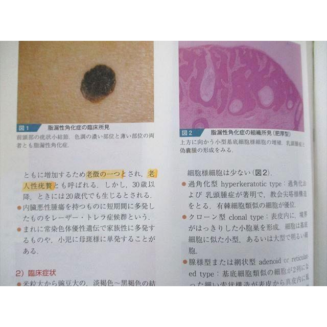 UP81-073 文光堂 皮膚疾患診療実践ガイド―診察室ですぐに役立つ卓上リファレンス 2009 30S3D