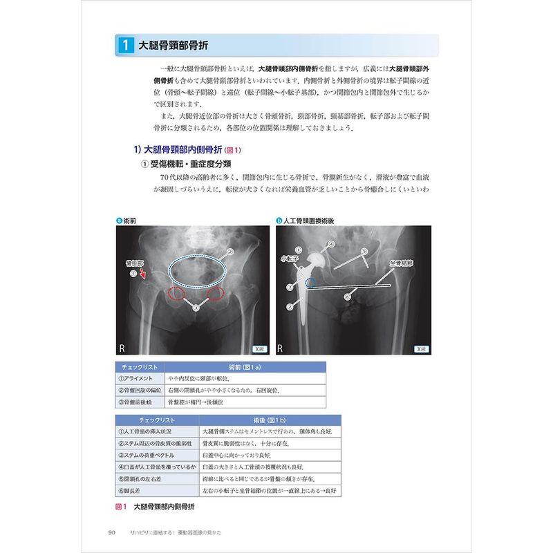 リハビリに直結する 運動器画像の見かた