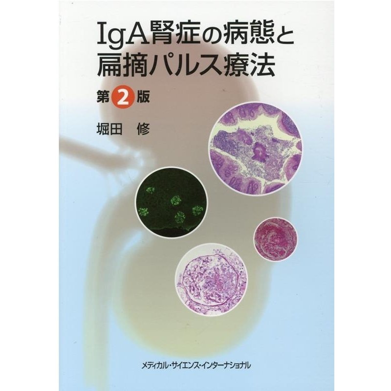 IgA腎症の病態と扁摘パルス療法 堀田修