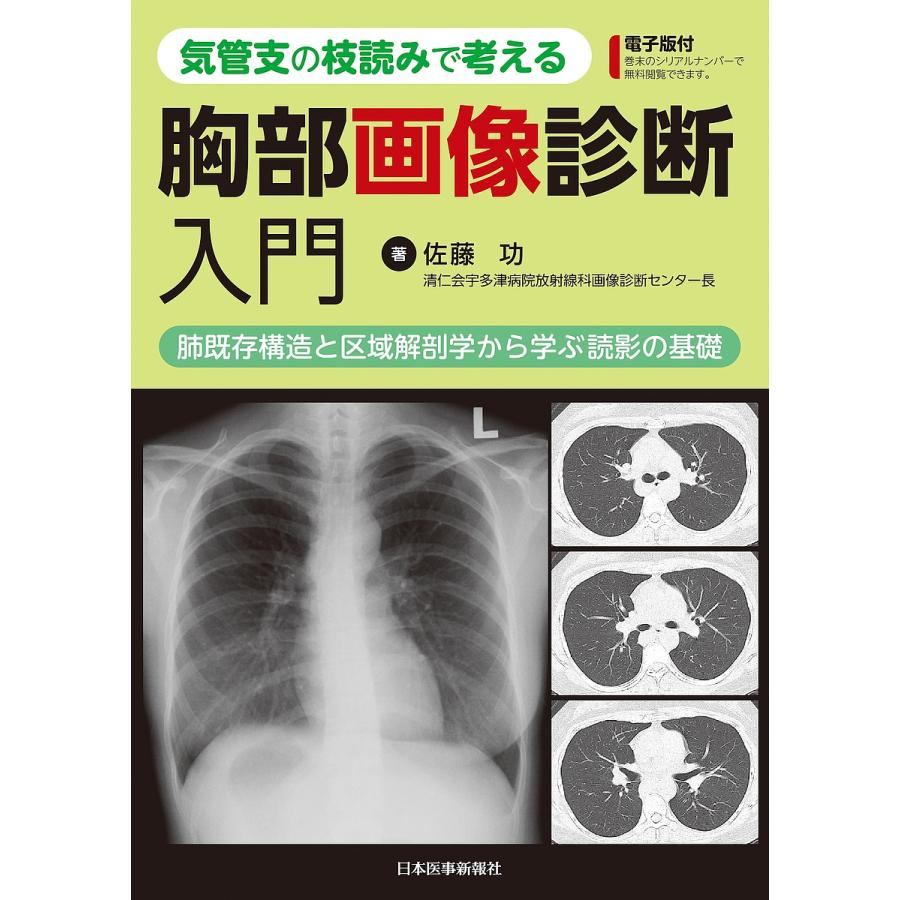 気管支の枝読みで考える胸部画像診断入門 肺既存構造と区域解剖学から学ぶ読影の基礎