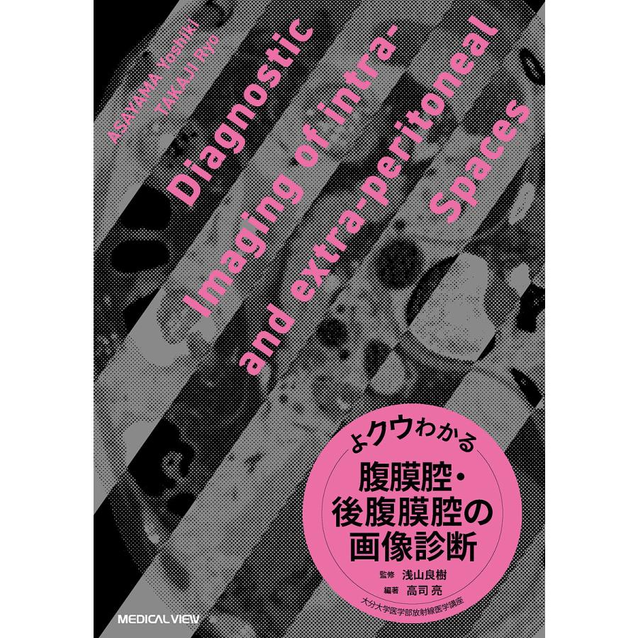 よクウわかる腹膜腔・後腹膜腔の画像診断