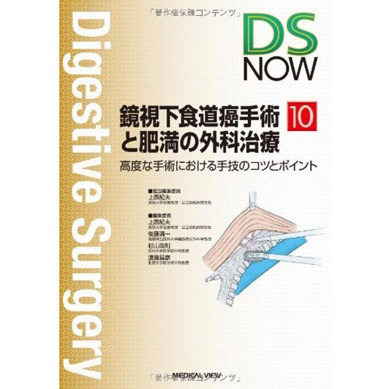 鏡視下食道癌手術と肥満の外科治療−高度な手術における手技のコツとポイント (DS NOW 10)