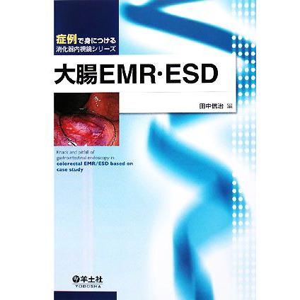 大腸ＥＭＲ・ＥＳＤ 症例で身につける消化器内視鏡シリーズ／田中信治