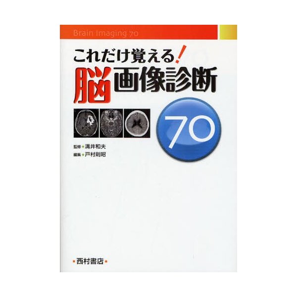 これだけ覚える 脳画像診断70