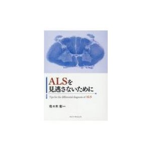 ALSを見逃さないために   佐々木彰一  〔本〕